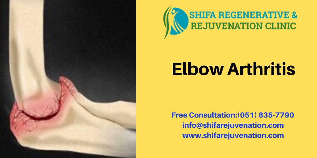 Shifa Regenerative and Rejuvenation Clinic for Elbow Arthritis: